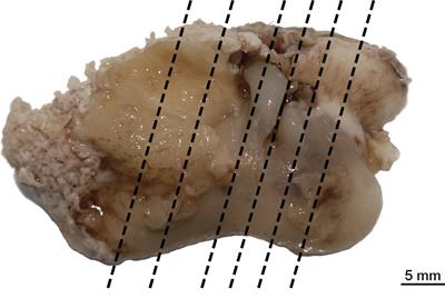 Fatal aspergillosis and evidence of unrelated hearing loss in a harbor porpoise (Phocoena phocoena) from the German Baltic Sea